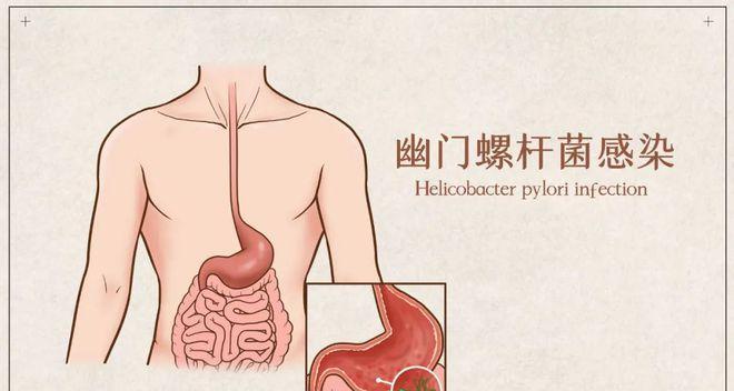 辐射4血清获取方法是什么？血清在游戏中的作用有哪些？